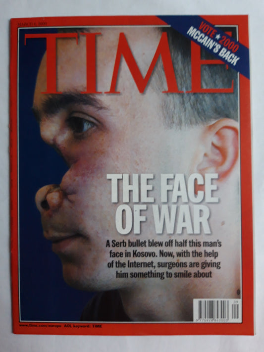 Time magazine The face of war A Serb bullet blew off half this man`s face in Kosovo Help of the Internet Surgeons are giving him something to smile about Vote 2000 Mccain`s Back 06.03.2000 March März 2000